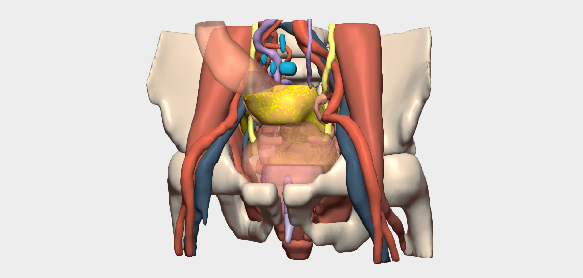 Planificación 3D de cirugía de cáncer de recto en el Hospital General de México