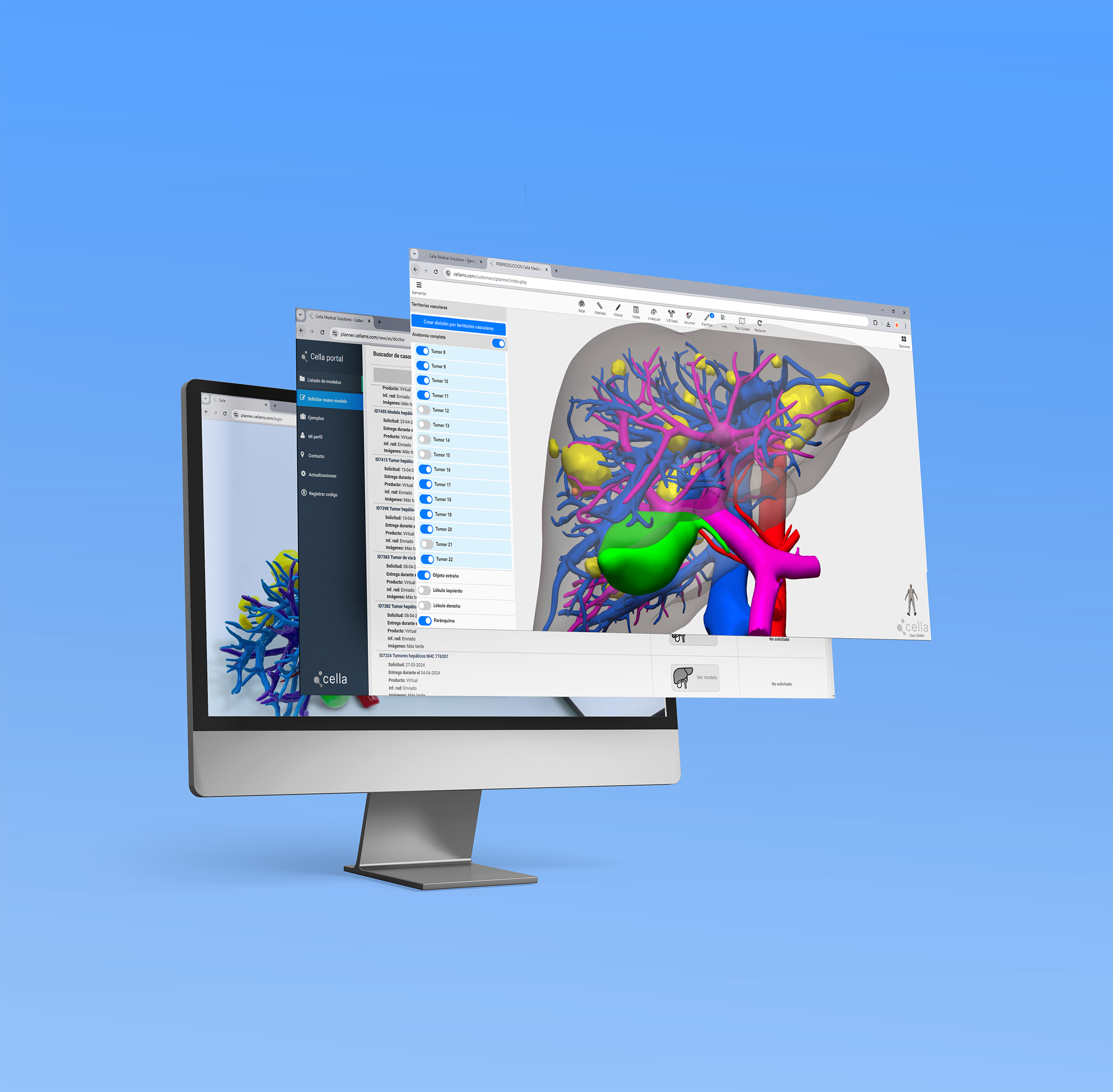 Aplicaciones médicas del modelado 3D