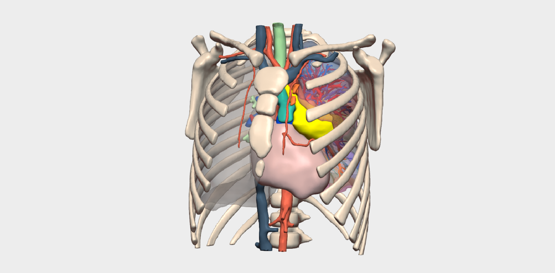 Resección de sarcoma de Ewing costal en paciente pediátrico con modelo 3D