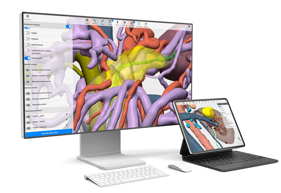 Visualización de los modelos 3D para cirugía en ordenador y tablet