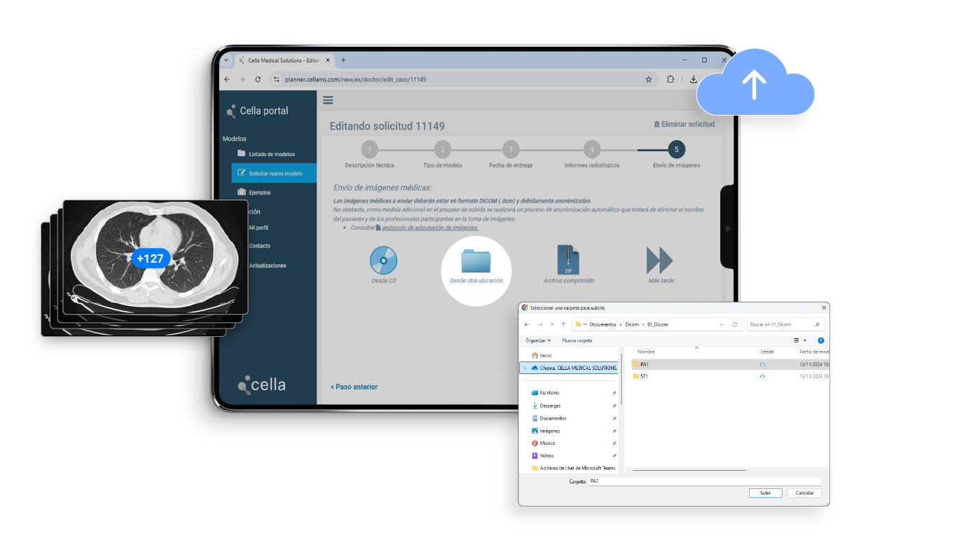 Proceso de subida de imágenes médicas para la creación de modelos 3D para cirugía