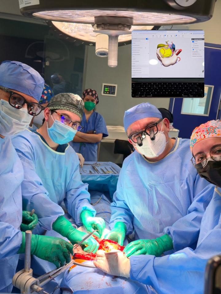 tumor sólido pseudopapilar de cabeza de páncreas (tumor de Frantz-Gruber)