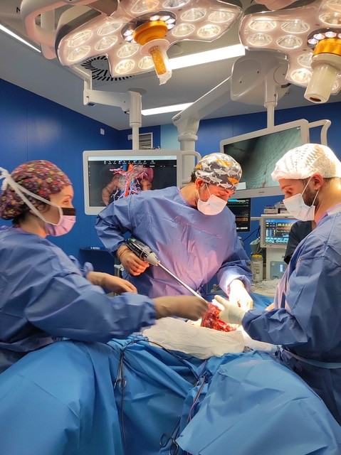 Colectomía segmentaria del ángulo esplénico con modelo 3D